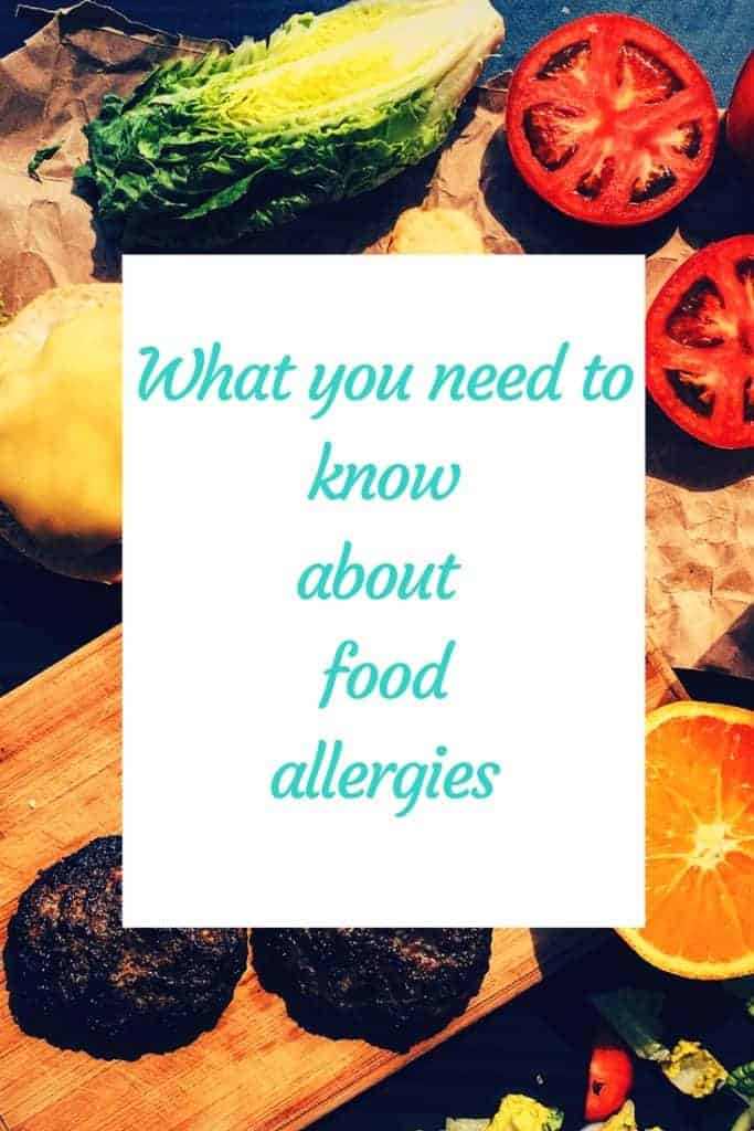 Facts you need to know about food allergies and the most common allergens via hispanaglobal.net