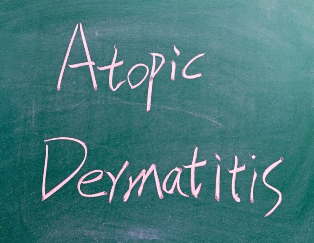 Do you have dry, itchy skin? You might be one of 31 million people who suffer from atopic dermatitis, a form of eczema. Here are the top skincare tips to help you manage it.